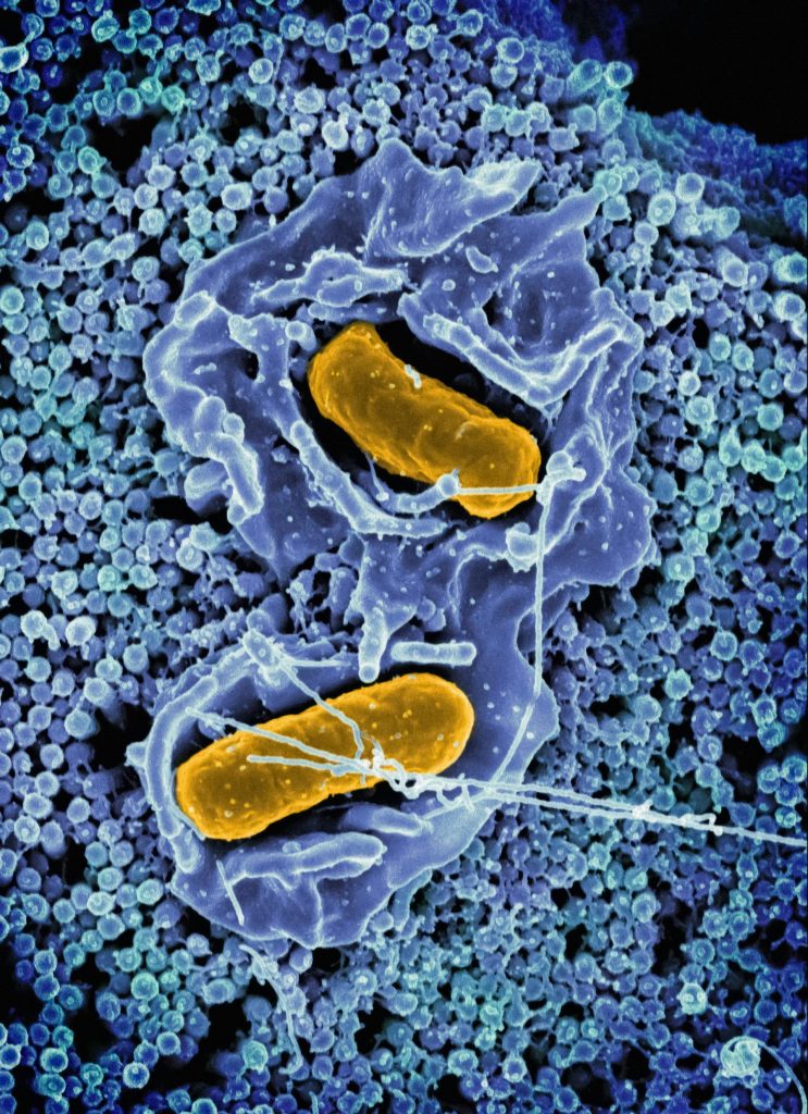 a cell with two yellow cells inside of it